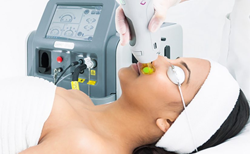 Achieving Flawless Results through Precision Diode Laser Hair Removal
