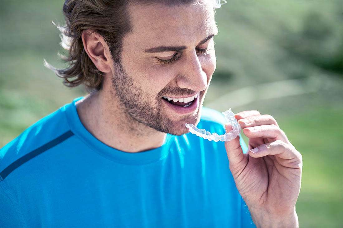 Invisalign: The Science of Subtle Smile Adjustments